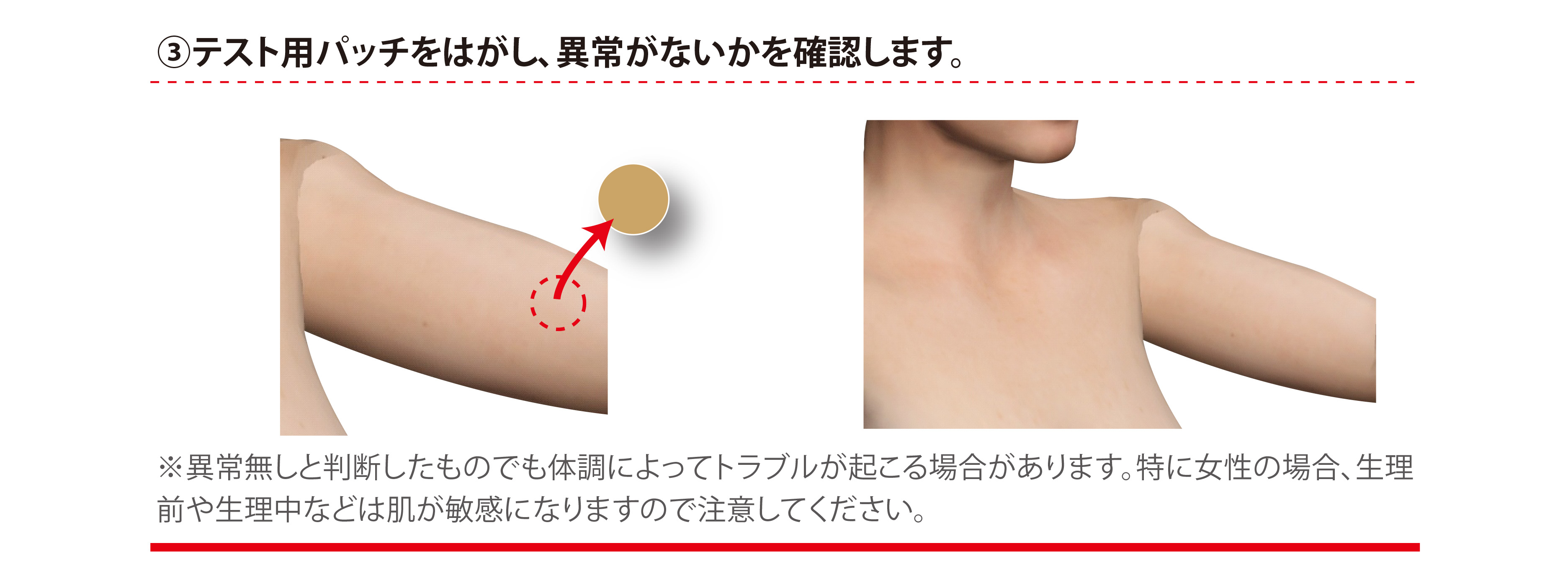 パッチテストの方法