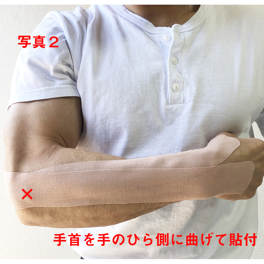 前腕伸筋群のサポートテープ（テニス肘・外側上顆炎）