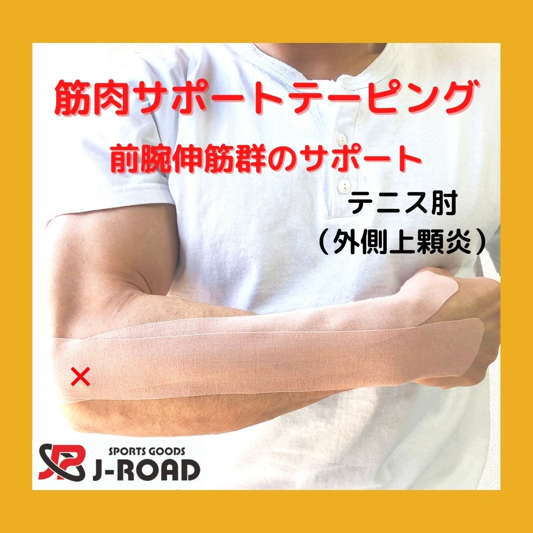 前腕伸筋群のサポートテープ テニス肘 外側上顆炎 ジェイロードスポーツ キネシオロジーテープ キロテープなどの商品を販売中 前腕伸筋群のサポートテープ テニス肘 外側上顆炎 ジェイロードスポーツ キネシオロジーテープ キロテープなどの商品を販売中