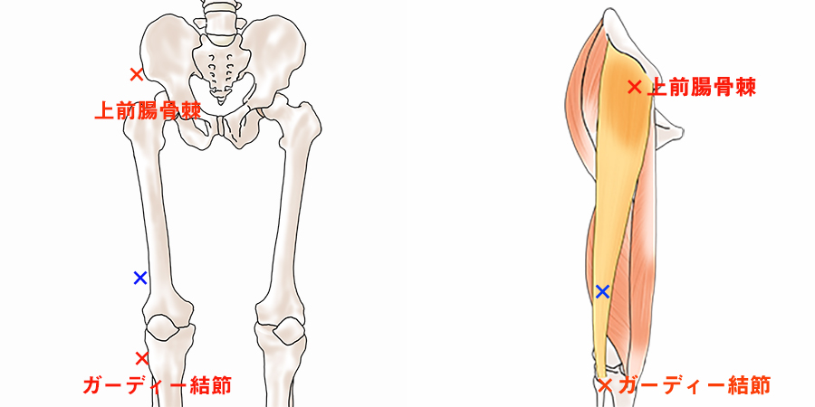 大腿筋膜張筋（腸脛靭帯）のサポートテーピング（腸脛靭帯炎・ランナー膝）