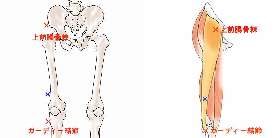 大腿筋膜張筋（腸脛靭帯）のサポートテーピング（腸脛靭帯炎・ランナー膝）
