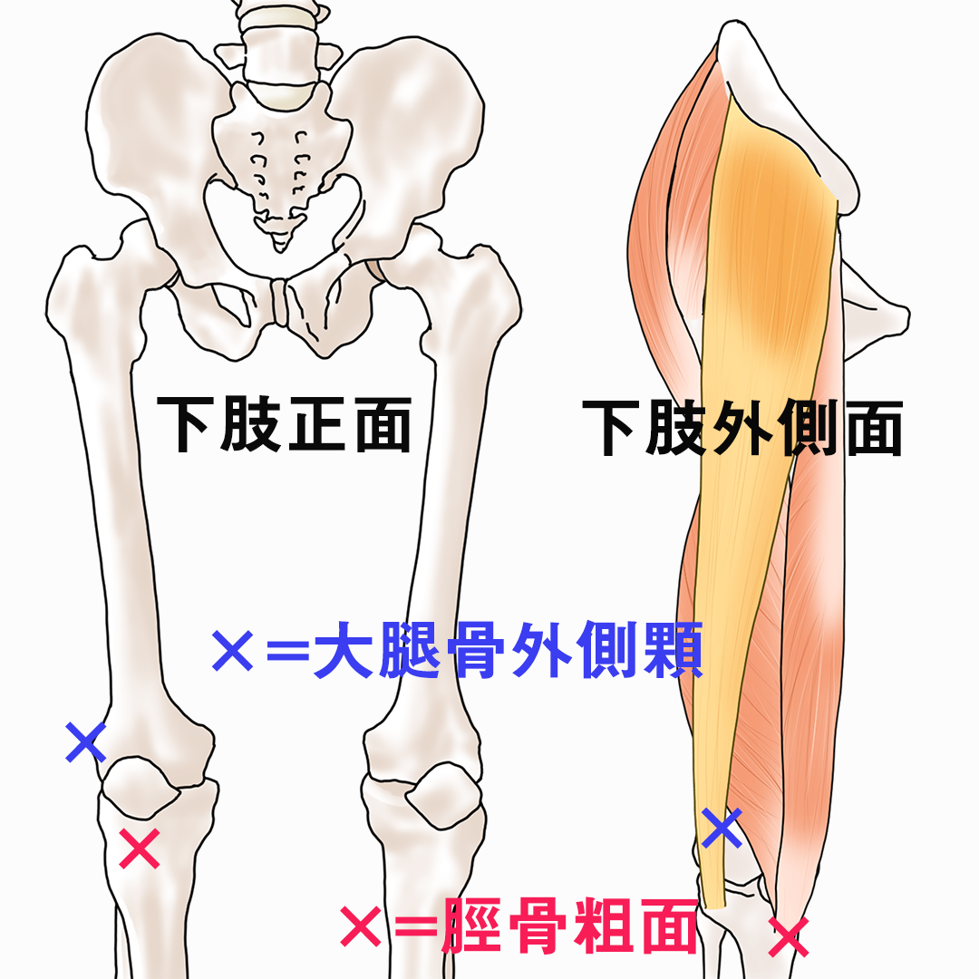 膝関節の外旋誘導（腸脛靭帯炎・ランナーズニー）