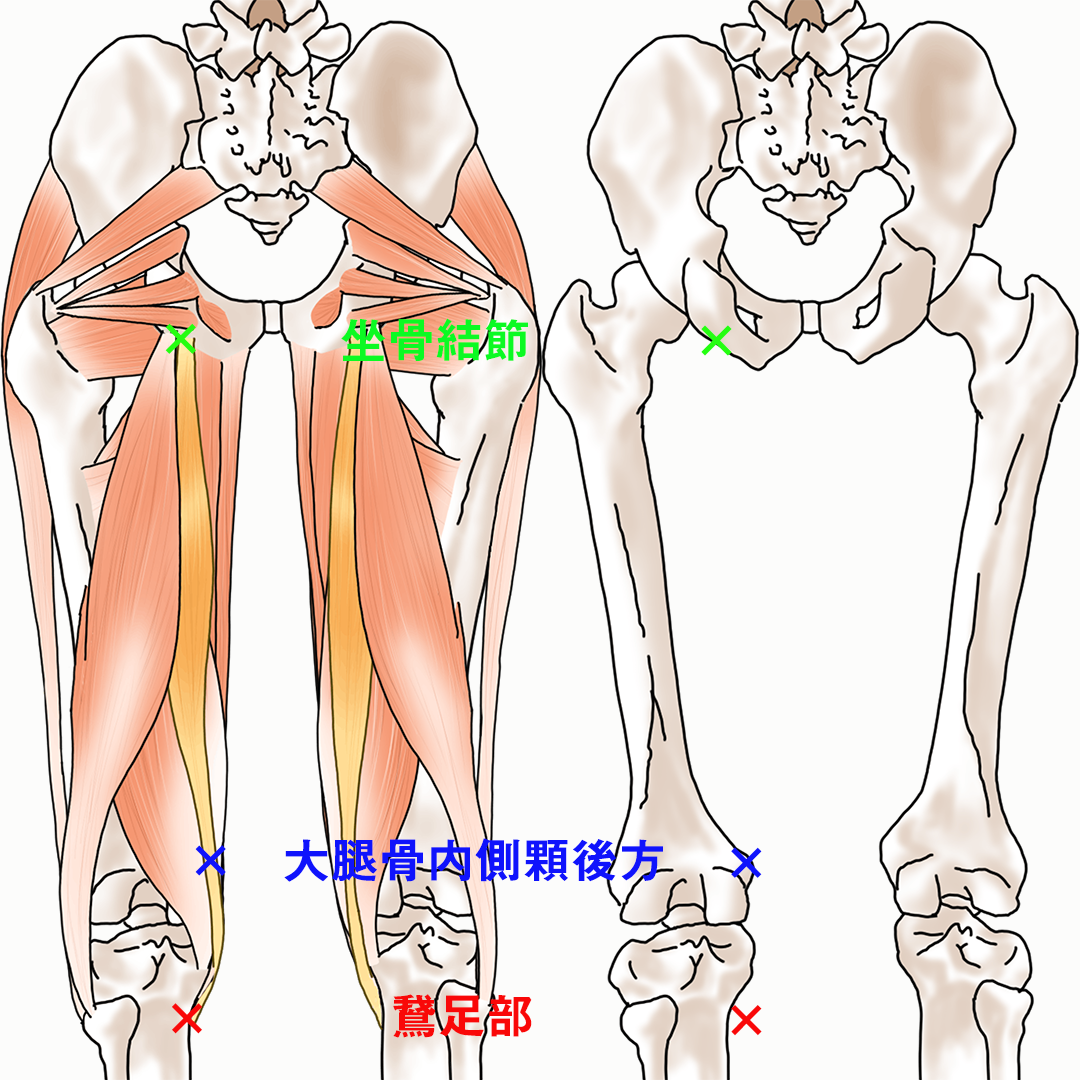 半腱様筋のサポートテーピング（鵞足炎）